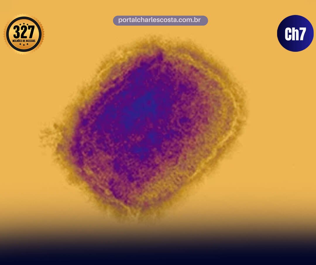 são paulo confirma segundo caso de nova variante de mpox