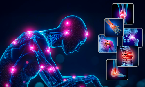 Lei_que_reconhece_fibromialgia_como_deficiência_passa_valer_em_2026