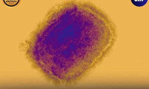 são paulo confirma segundo caso de nova variante de mpox