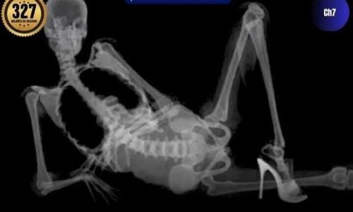 ter relação sexual mais de duas vezes por semana, para mulheres, aumenta a imunidade.